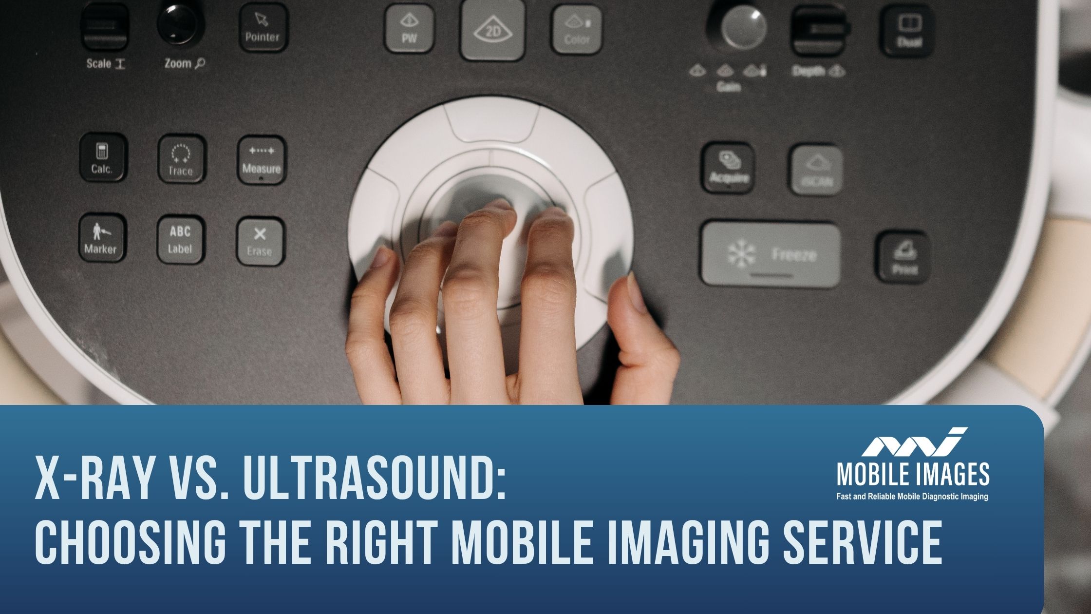X-Ray vs. Ultrasound